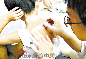 灸法的種類  你知道多少？
